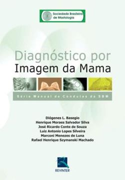 Imagem de DIAGNOSTICO POR IMAGEM DA MAMA