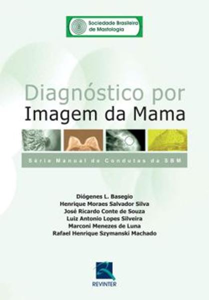 Picture of DIAGNOSTICO POR IMAGEM DA MAMA