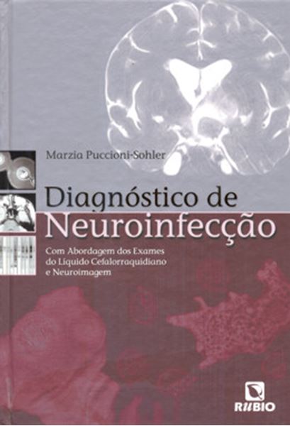 Picture of DIAGNOSTICO DE NEUROINFECCAO