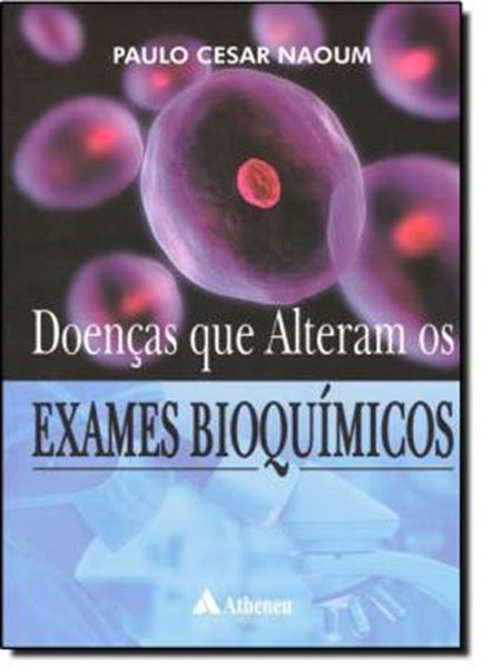 Picture of DOENCAS QUE ALTERAM OS EXAMES BIOQUIMICOS
