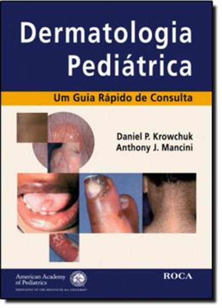 Picture of DERMATOLOGIA PEDIATRICA - UM GUIA RAPIDO DE CONSULTA