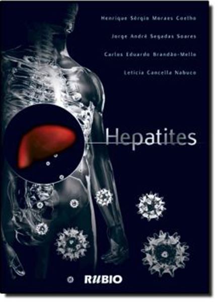 Picture of HEPATITES