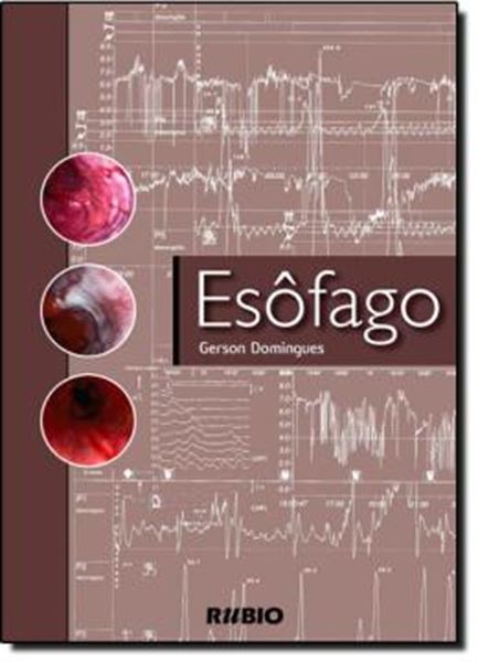 Picture of ESOFAGO