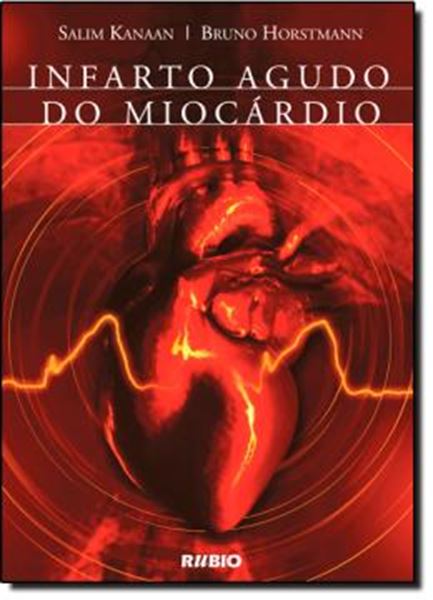 Picture of INFARTO AGUDO DO MIOCARDIO