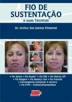 Imagem de FIO DE SUSTENTACAO E SUAS TECNICAS
