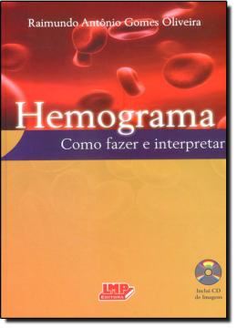 Imagem de HEMOGRAMA: COMO FAZER E INTERPRETAR