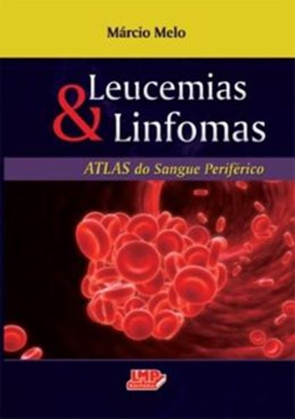 Picture of LEUCEMIAS E LINFOMAS