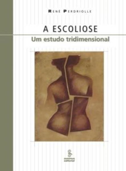 Picture of ESCOLIOSE, A