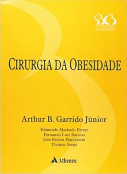 Picture of CIRURGIA DA OBESIDADE