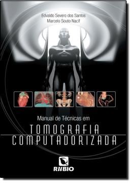 Imagem de MANUAL DE TECNICAS EM TOMOGRAFIA COMPUTADORIZADA