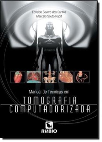 Picture of MANUAL DE TECNICAS EM TOMOGRAFIA COMPUTADORIZADA