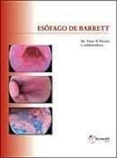 Picture of ESOFAGO DE BARRETT