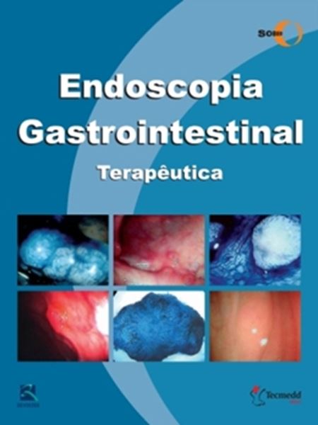 Picture of ENDOSCOPIA GASTROINTESTINAL  TERAPEUTICA