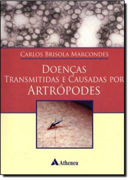 Picture of DOENCAS TRANSMITIDAS E CAUSADAS POR ARTROPODES