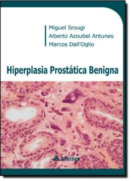 Imagem de HIPERPLASIA PROSTATICA BENIGNA