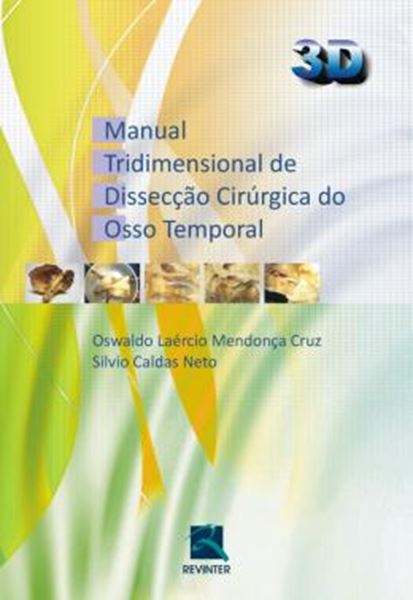 Picture of MANUAL TRIDIMENCIONAL DE DISSECCAO CIRURGICA DO OSSO TEMPORAL - 3D