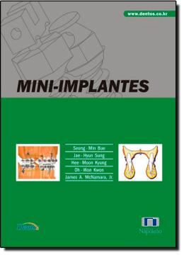 Imagem de MINI-IMPLANTES