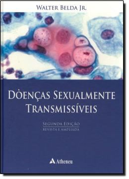 Imagem de DOENCAS SEXUALMENTE TRANSMISSIVEIS - 2ª EDICAO