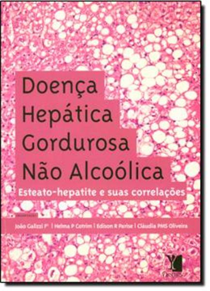 Picture of DOENCA HEPATICA GORDUROSA NAO ALCOOLICA