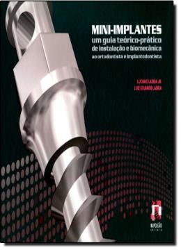 Imagem de MINI-IMPLANTES - UM GUIA TEORICO-PRATICO DE INSTALACAO E BIOMECANICA AO ORTODONTISTA E IMPLANTODONTISTA