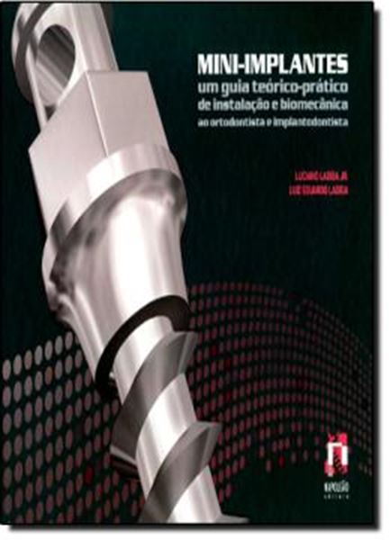 Picture of MINI-IMPLANTES - UM GUIA TEORICO-PRATICO DE INSTALACAO E BIOMECANICA AO ORTODONTISTA E IMPLANTODONTISTA