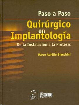Imagem de PASO A PASO QUIRURGICO EN IMPLANTOLOGIA