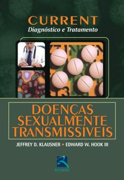 Picture of CURRENT DIAGNOSTICO E TRATAMENTO - DOENCAS SEXUALMENTE TRANSMISSIVEIS 