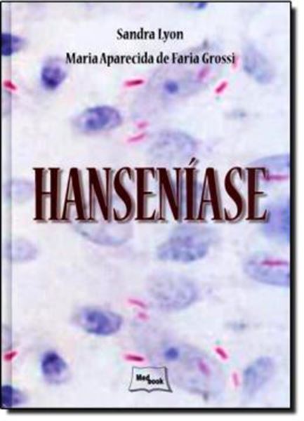Picture of HANSENIASE