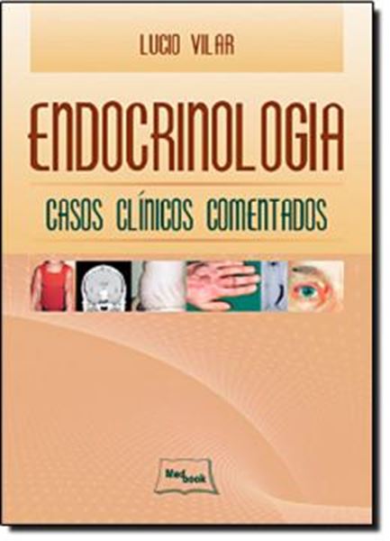 Picture of ENDOCRINOLOGIA - CASOS CLINICOS COMENTADOS