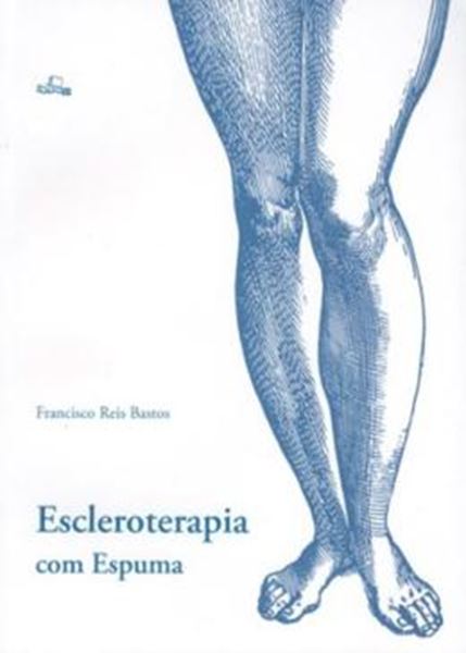 Picture of ESCLEROTERAPIA COM ESPUMA