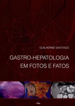 Imagem de GASTRO-HEPATOLOGIA EM FOTOS E FATOS