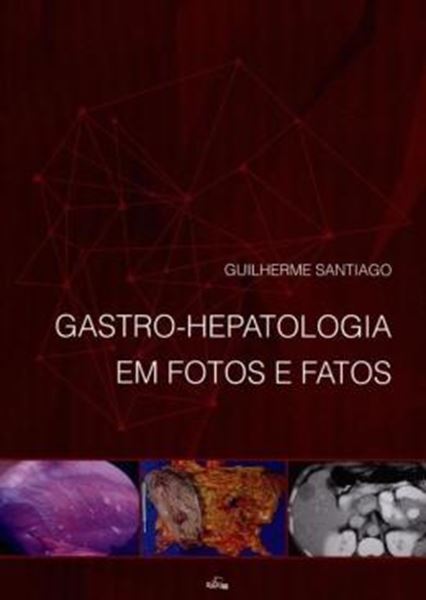 Picture of GASTRO-HEPATOLOGIA EM FOTOS E FATOS