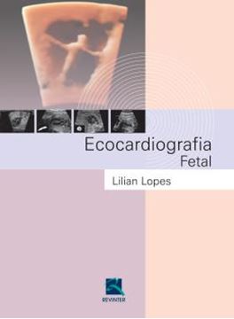 Imagem de ECOCARDIOGRAFIA FETAL