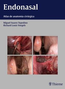 Imagem de ENDONASAL - ATLAS DE ANATOMIA CIRURGICA