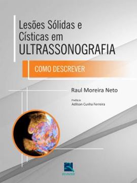 Imagem de LESOES SOLIDAS E CISTICAS EM ULTRASSONOGRAFIA - COMO DESCREVER