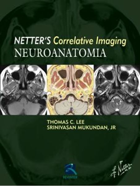 Picture of NEUROANATOMIA - NETTERS CORRELATIVE IMAGING  