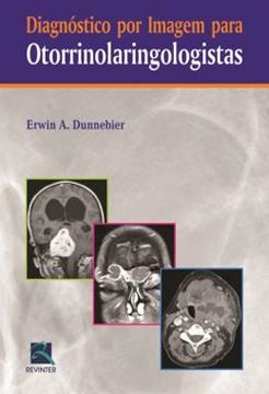 Imagem de DIAGNOSTICO POR IMAGEM PARA OTORRINOLARINGOLOGISTAS