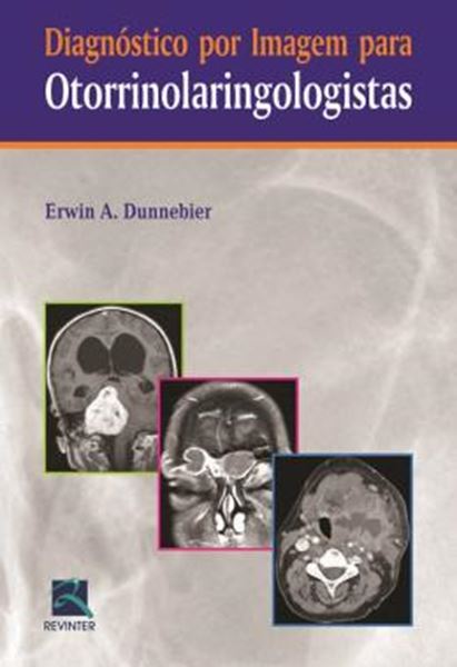 Picture of DIAGNOSTICO POR IMAGEM PARA OTORRINOLARINGOLOGISTAS