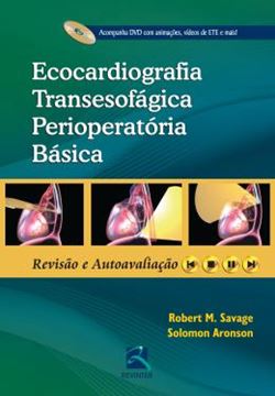 Imagem de ECOCARDIOGRAFIA TRANSESOFAGICA PERIOPERATORIA BASICA