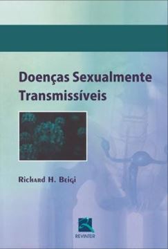 Imagem de DOENCAS SEXUALMENTE TRANSMISSIVEIS