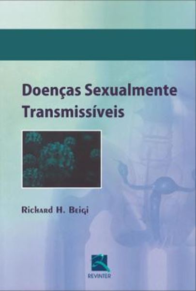 Picture of DOENCAS SEXUALMENTE TRANSMISSIVEIS