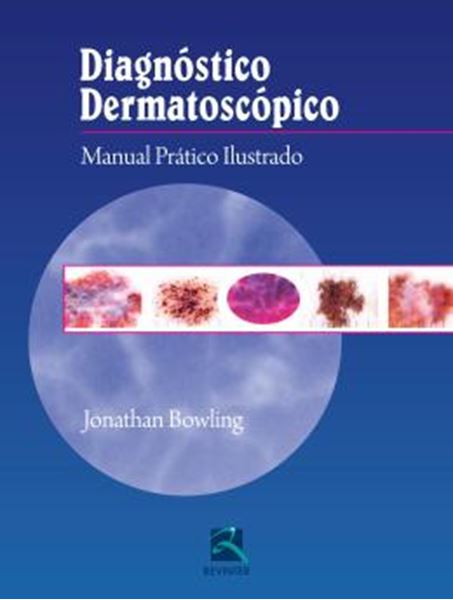 Picture of DIAGNOSTICO DERMATOSCOPICO - MANUAL PRATICO ILUSTRADO