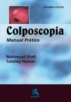 Imagem de COLPOSCOPIA - MANUAL PRATICO - 2ª ED