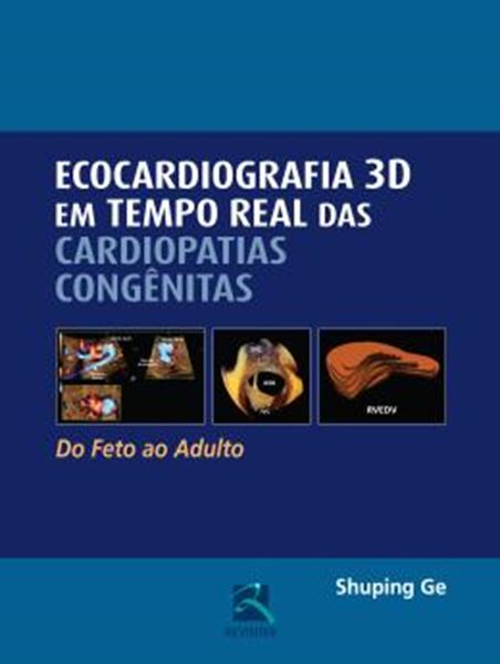 Picture of ECOCARDIOGRAFIA 3D EM TEMPO REAL DAS CARDIOPATIAS CONGENITAS 