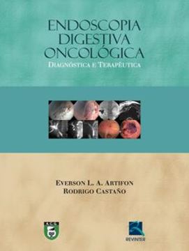 Imagem de ENDOSCOPIA DIGESTIVA ONCOLOGICA - DIAGNOSTICA E TERAPEUTICA