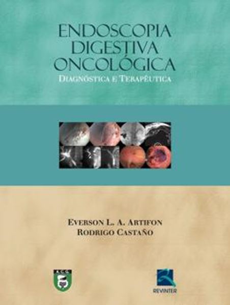 Picture of ENDOSCOPIA DIGESTIVA ONCOLOGICA - DIAGNOSTICA E TERAPEUTICA