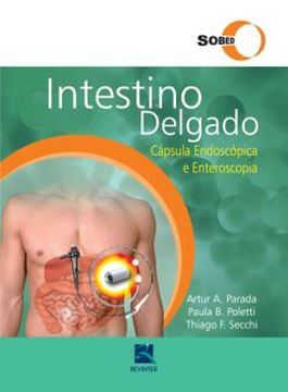 Imagem de INTESTINO DELGADO - CAPSULA ENDOSCOPICA E ENTEROSCOPIA