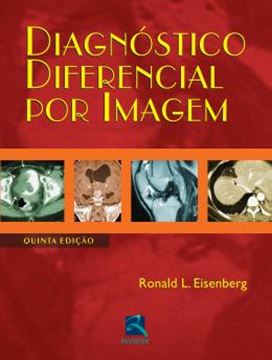 Imagem de DIAGNOSTICO DIFERENCIAL POR IMAGEM