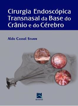 Imagem de CIRURGIA ENDOSCOPICA TRANSNASAL DA BASE DO CRANIO E DO CEREBRO