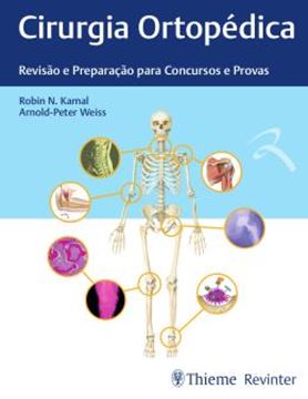 Imagem de CIRURGIA ORTOPEDICA